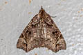 Parolulis renalis
